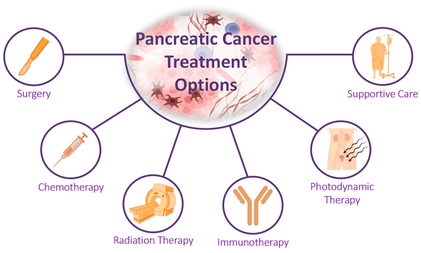 Pancreatic Cancer Treatment in 2025: Innovations and Hope for the Future